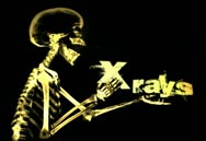 XRAYS